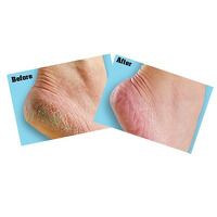 Gorilla Glue OKeeffes Healthy Feet Foot Cream  85g Tube